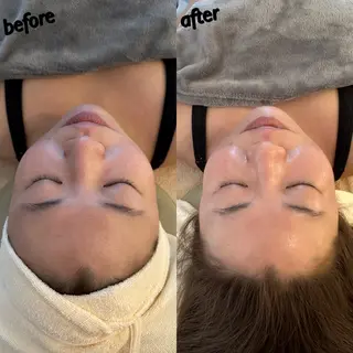 うなじ脱毛/美肌脱毛 LABELのエステ・リラクイメージ