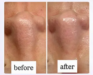 Salon【yuzu.】所属・🍊肌管理×美眉 【yuzu.】の眉毛・アイブロウイメージ