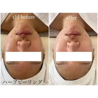 I'm -ｲﾑ-所属・肌質改善／ブライダル I'm.-イム-のエステ・リラクイメージ