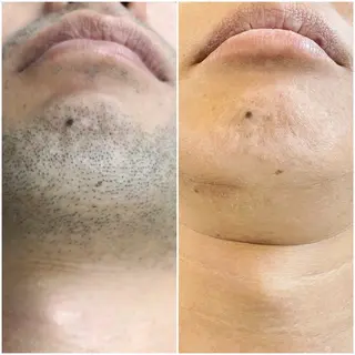 脱毛専門サロンElixir加須店所属・脱毛専門サロン Elixir　加須店のエステ・リラクイメージ