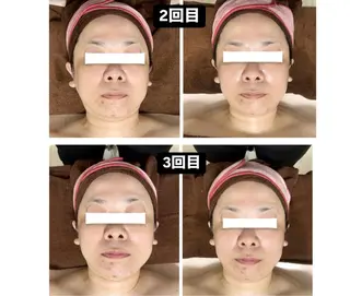 private  salon  MALIA所属・エステ MALIAのエステ・リラクイメージ