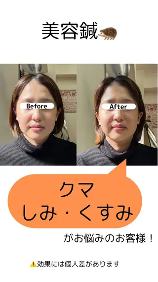 出張鍼灸師 miyuのエステ・リラクイメージ