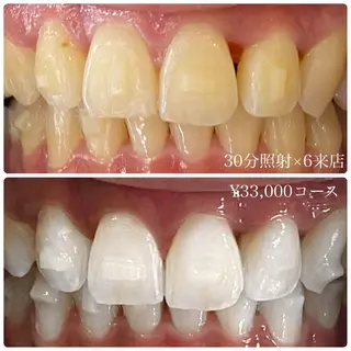 PLATINUM Beauty 横浜店所属・ホワイトニングルーム 横浜店のその他イメージ