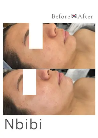 韓国🇰🇷価格 サロン_Nbibiのエステ・リラクイメージ