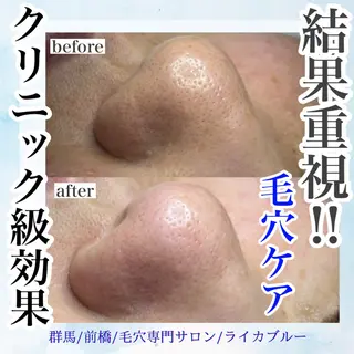 毛穴専門サロン ライカブルーのエステ・リラクイメージ