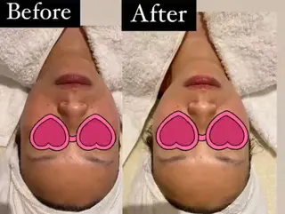 MENARD BLOOMのエステ・リラクイメージ