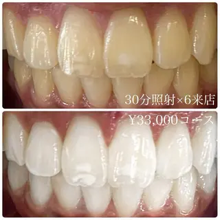 PLATINUM Beauty 横浜店所属・ホワイトニングルーム 横浜店のその他イメージ