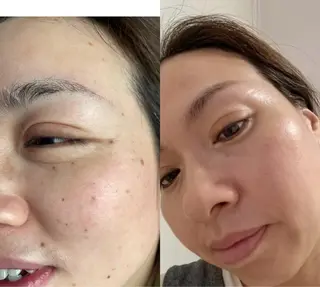 ビューティーリゾート麗所属・于 麗影のエステ・リラクイメージ