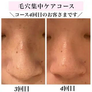 Bellesthe （ベルエステ）のエステ・リラクイメージ