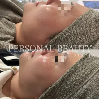 PERSONAL BEAUTY🪻のエステ・リラクイメージ