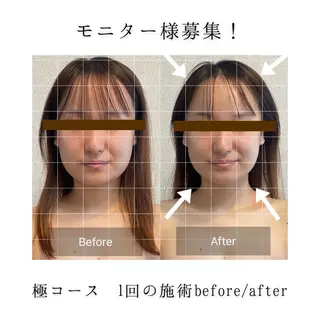 小顔集中型エステ 堺／大美野のエステ・リラクイメージ