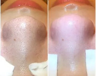 ワックス脱毛専門店 ICE北千住のエステ・リラクイメージ