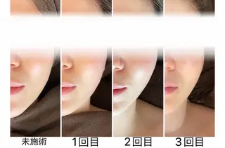 MIRAI小顔 溝の口店のエステ・リラクイメージ