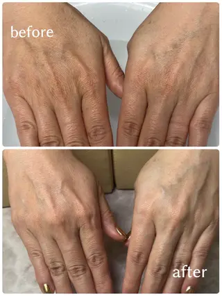 ネイル 東 真百のネイルデザイン