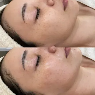 salon moi(モア)のエステ・リラクイメージ