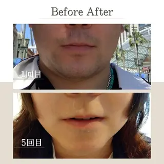 メンズ EDEL エーデルのエステ・リラクイメージ