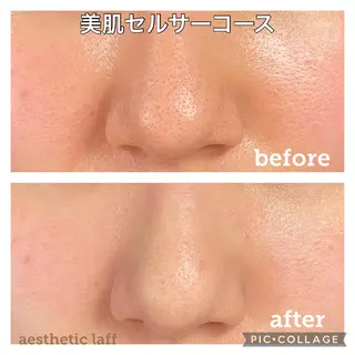 aesthetic laff所属・美肌作りのサロン 山村亜美のエステ・リラクイメージ