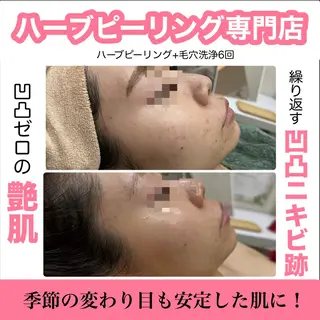 ハーブピーリング専門 muro.のエステ・リラクイメージ