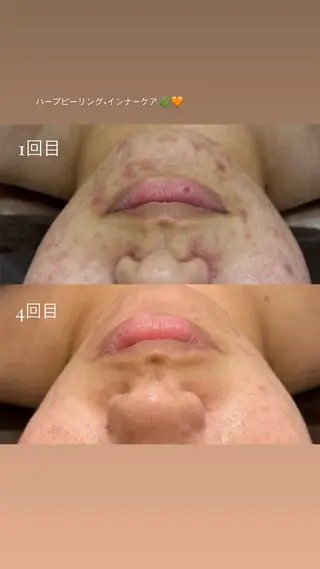 Nicore所属・肌質改善🌿まつ毛 chapiのその他イメージ