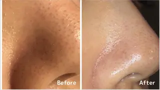 アンジェリック ビーナス　Rinonのエステ・リラクイメージ