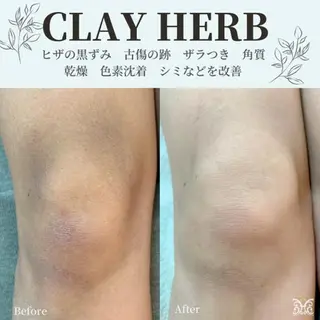 美肌&アロマ🌸 nana 中目黒のエステ・リラクイメージ