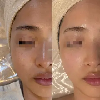 anthes /MIHOのエステ・リラクイメージ