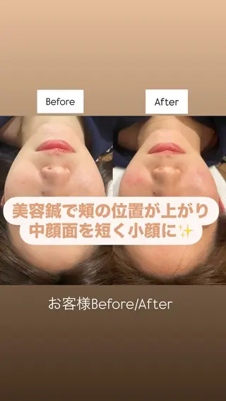 美容鍼/鍼灸 ここみ鍼灸院のエステ・リラクイメージ