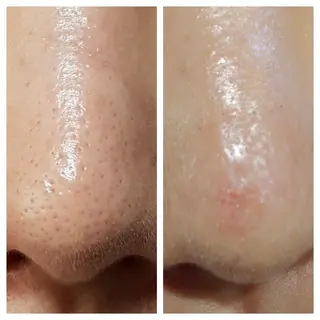 整体エステ　NEW ME所属・深層リンパオイル/小 顔とドライヘッドスパのエステ・リラクイメージ