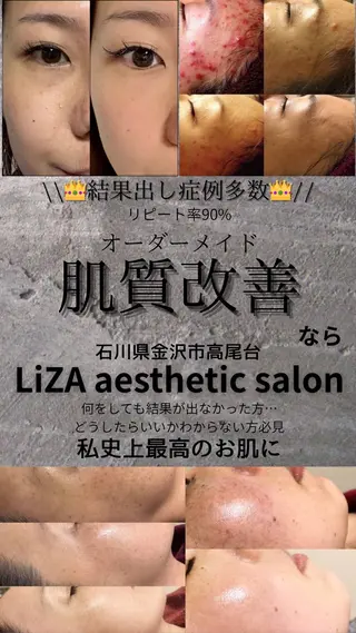 LiZA エステティックサロンのエステ・リラクイメージ