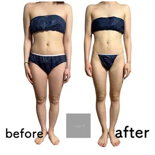 marron所属・痩身ハイパーナイフ ララピールリアボーテのエステ・リラクイメージ