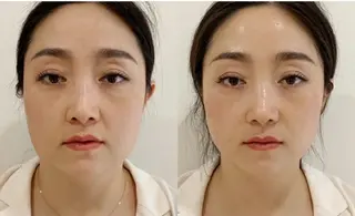 aliaハイフ&水光ジェットサロン所属・aliaハーブ水光店 エステティシャン募集のエステ・リラクイメージ