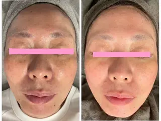 Private Salon Prunelle所属・プライベートサロン プリュネルのエステ・リラクイメージ