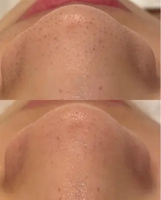 メンズ La・Bellvie所属・La･Bellvie 【星ヶ丘店]のエステ・リラクイメージ