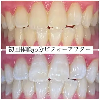 PLATINUM Beauty 横浜店所属・ホワイトニングルーム 横浜店のその他イメージ