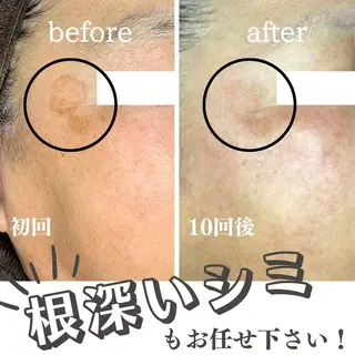 最新シミケアLily de pearlのエステ・リラクイメージ