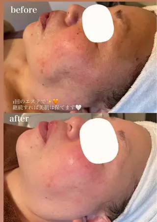 繁昌 春香のエステ・リラクイメージ