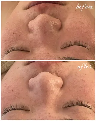 メンズ メナード岐阜茜部 杉浦のエステ・リラクイメージ