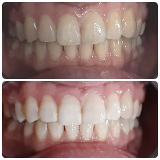 五十嵐 蓮のその他イメージ