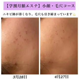 Bellesthe （ベルエステ）のエステ・リラクイメージ