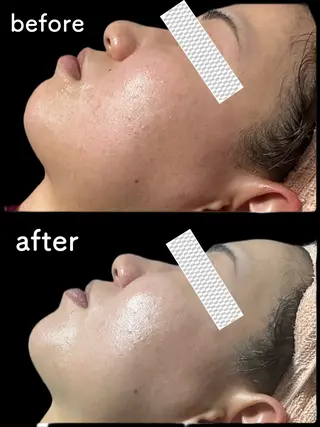 marron所属・痩身ハイパーナイフ ララピールリアボーテのエステ・リラクイメージ