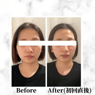 12Dハイフ💗 最強小顔のエステ・リラクイメージ