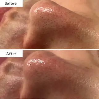 Beauty salon Lien所属・大村市Lien* 中川内翔子のエステ・リラクイメージ