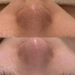 Nicore所属・肌質改善🌿まつ毛 chapiのその他イメージ