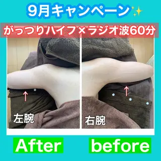 痩身/脱毛/ネイル HARUKAのエステ・リラクイメージ