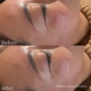 Luca所属・Luca ルカのエステ・リラクイメージ