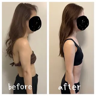 医療提携×美容整体 小顔ハイフピーリングのエステ・リラクイメージ