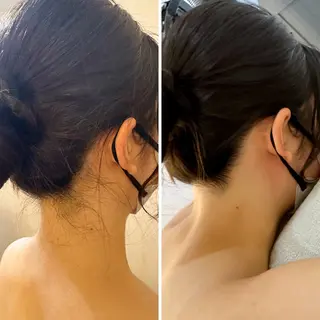 うなじ脱毛/美肌脱毛 LABELのエステ・リラクイメージ