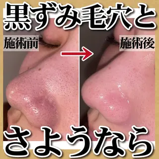 脱毛＆フェイシャル TOWA大宮のエステ・リラクイメージ