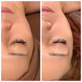 Meow！～トラブル肌専門ピーリング＆脱毛サロン～所属・トラブル肌改善🏥 Meow！🫧🫧のその他イメージ