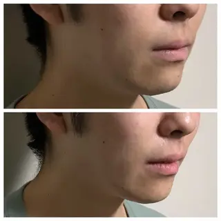 夜限定SARON YISMのエステ・リラクイメージ